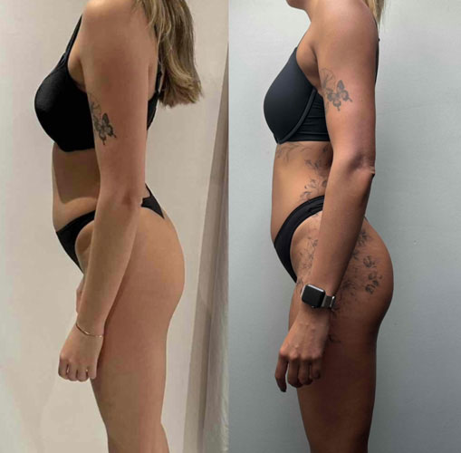 Transformation 3
